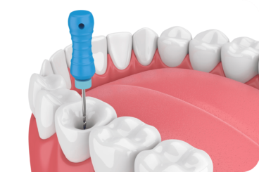 Endodontia