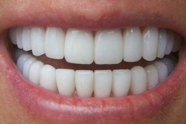 Medicina Dentária Funcional e Estética do Adulto